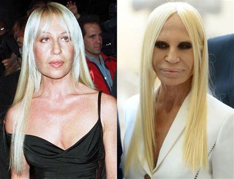 donatella versace daniel versace|Donatella Versace before and after.